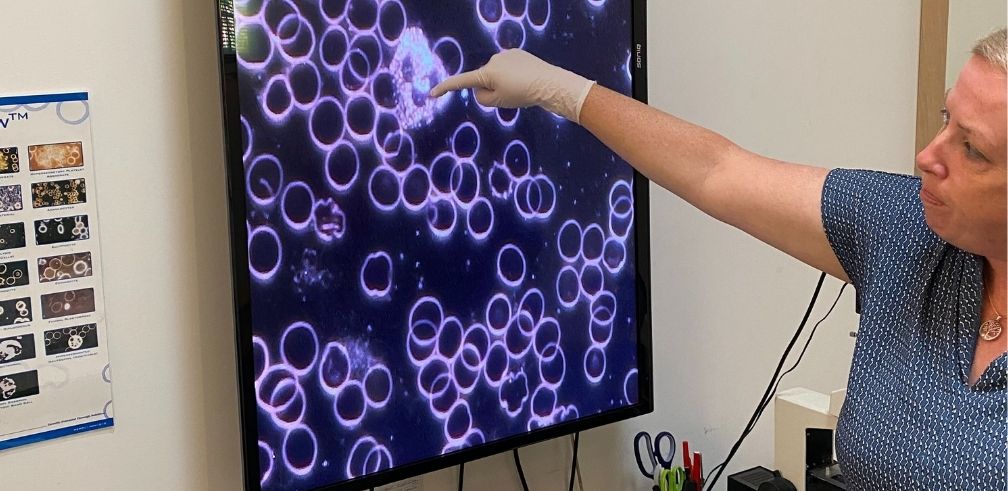 Katrina pointing at small circles on a screen that is showing blood highly magnified